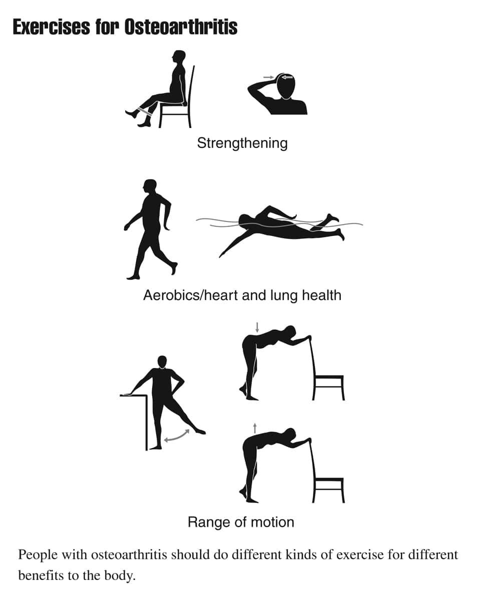 Osteoarthritis Causes Symptoms Treatment For Arthritic Pain Osteoarthritis Causes Symptoms Treatment For Arthritic Pain