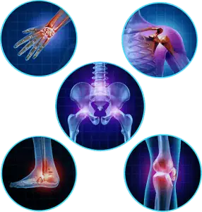 X-ray images of joints—hand, shoulder, hip, ankle, and knee—highlight inflammation or pain areas. Consider how stem cell therapy might offer relief for Lyme disease sufferers by addressing these joint issues. X-ray images of joints—hand, shoulder, hip, ankle, and knee—highlight inflammation or pain areas. Consider how stem cell therapy might offer relief for Lyme disease sufferers by addressing these joint issues.