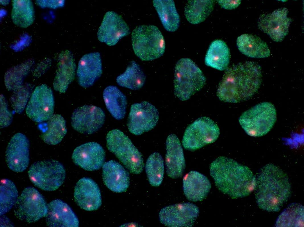 Closeup of iPSC stem cells