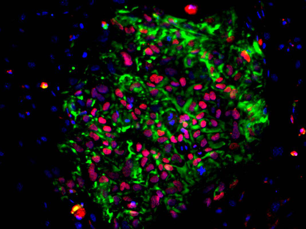Current research into iPSCs
