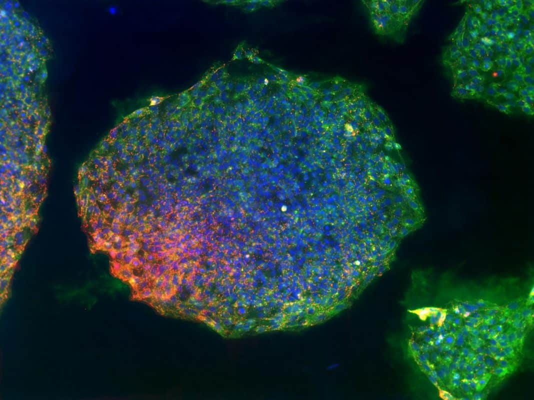 Closeup of frozen iPSC stem cell