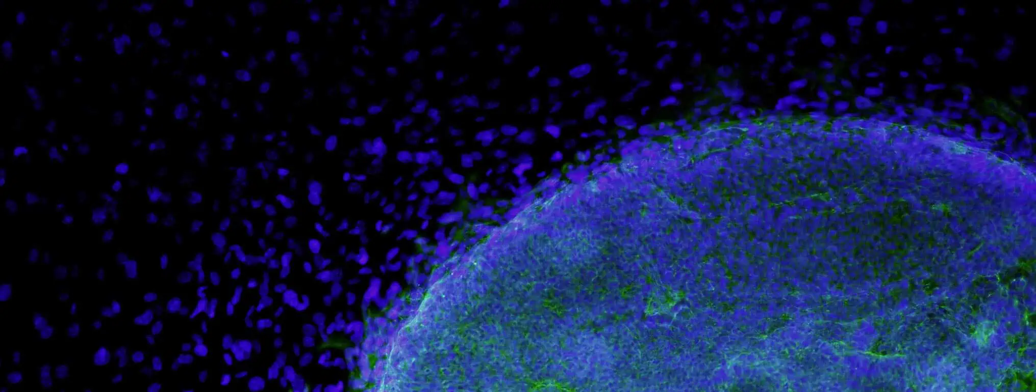 The Different Types of Cellular Therapy | Cell Therapy 101