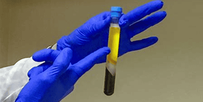 A person wearing blue gloves holds a test tube containing separated blood components, with yellow plasma on top and dark red at the bottom.