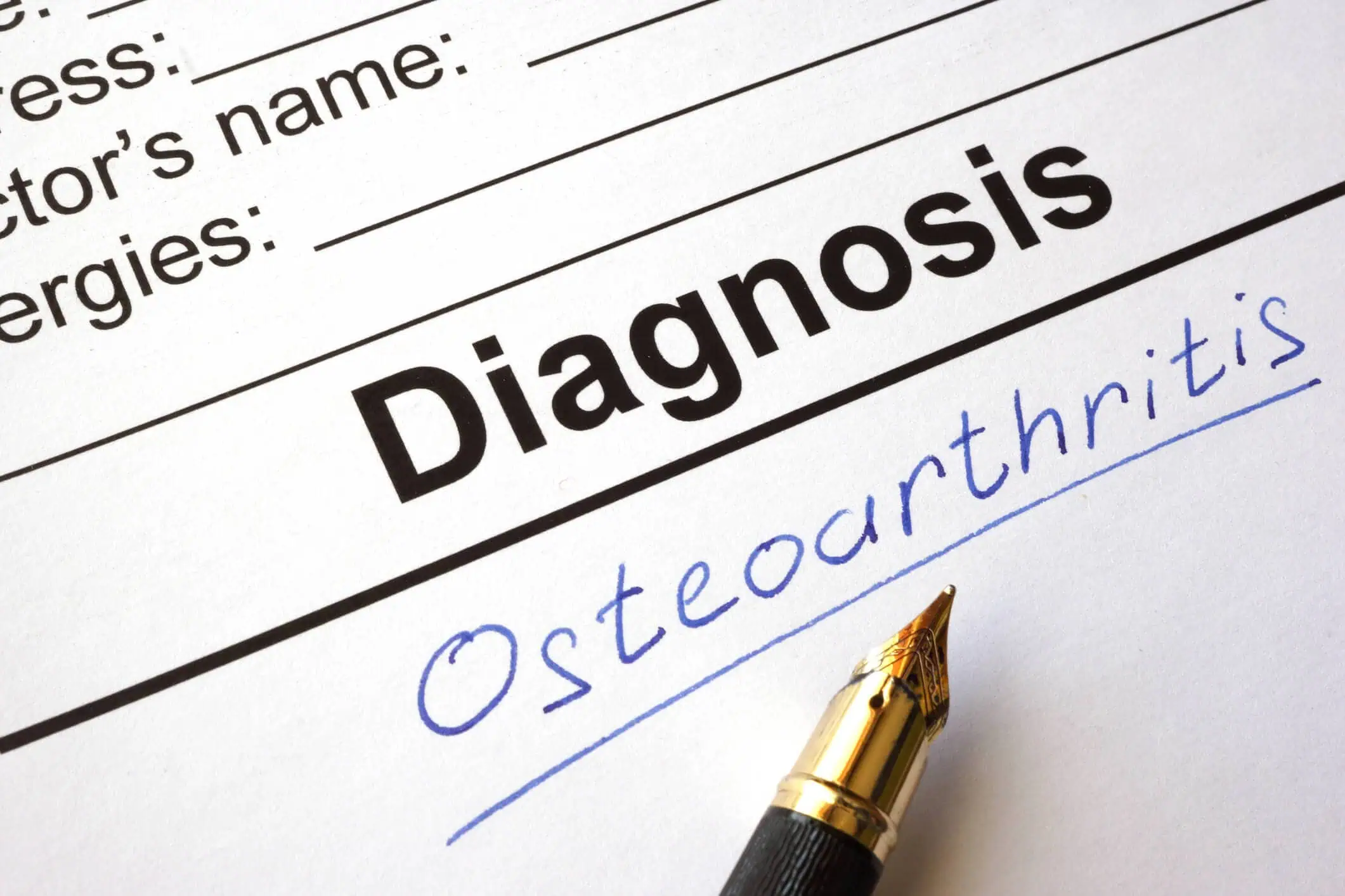Regenerative Medicine for Osteoarthritis