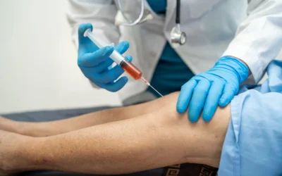 What to Expect During and After a Stem Cell Knee Injection