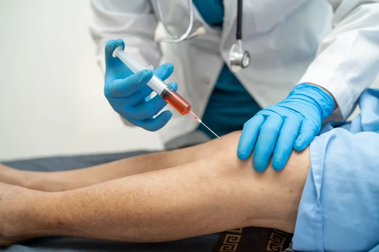 What to Expect During and After a Stem Cell Knee Injection