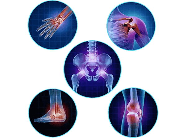 Medical illustration showing five highlighted joints: hand, shoulder, hip, ankle, and knee, each depicted with a focus on bones and pain points. Medical illustration showing five highlighted joints: hand, shoulder, hip, ankle, and knee, each depicted with a focus on bones and pain points.